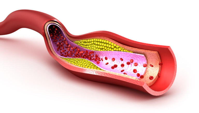 how-much-cholesterol-per-day--1024x584